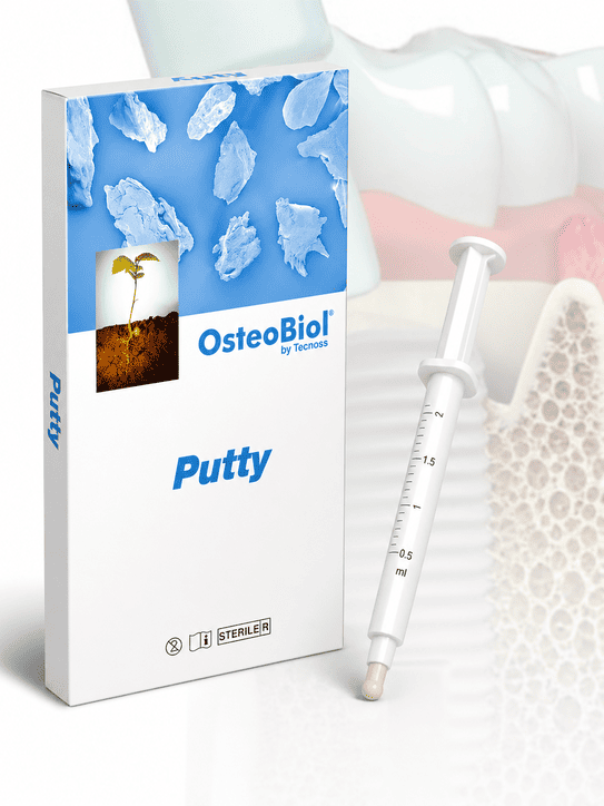 Putty OsteoBiol jeringa